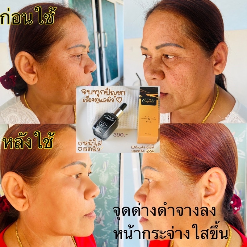 ส่งฟรีเซรั่มหน้าใส100-เซรั่ม-คอลลาเจน-วิตามิน-ลดฝ้า-กระ-จุดด่างดำ