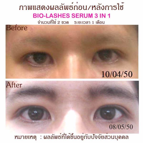 แพคคู่-bio-lashes-เซรั่มสมุนไพรเร่งขนตายาวและหนาขึ้น