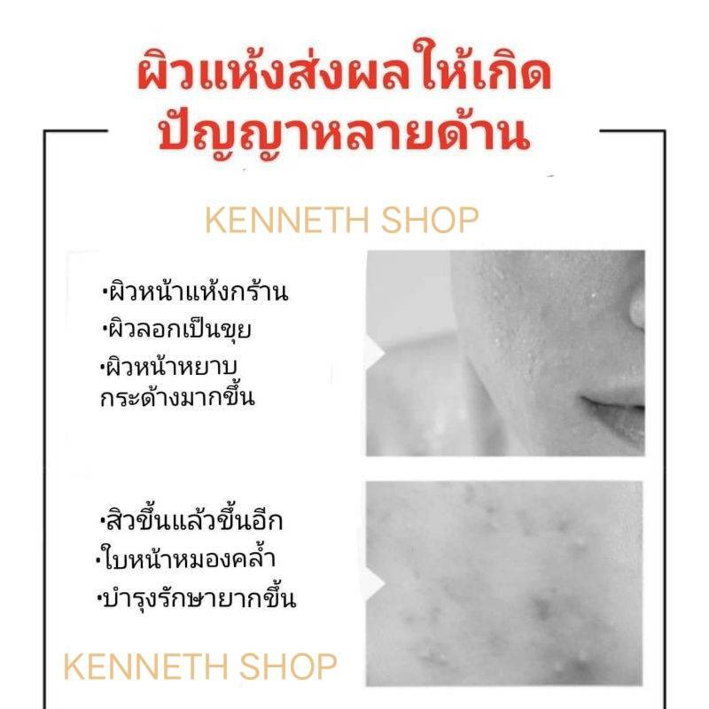 เซรั่มไวท์เทนนิ่ง-หน้าขาวใส-ลดฝ้า-จุดด่างดำ-กระชับรูขุมขนvenzn15ml