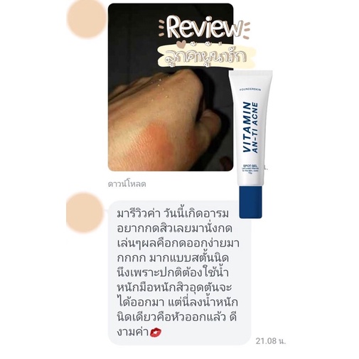 แท้-เจลละลายสิว-founderskin-vitamin-anti-acne-เจลละลายสิว-ลดสิวอุดตัน