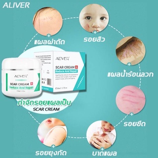💥พร้อมส่งทันที💥 ครีมลดรอยแผลเป็น ลดรอยสิว รอยแผลไฟไหม้ กำจัดรอยแผลเป็น รอยหลังคลอด