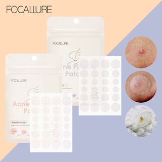 Focallure แผ่นแปะสิว กันน้ํา ติดทนนาน สําหรับกลางวัน และกลางคืน FA186-2