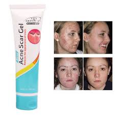 acne-scar-gel-ให้ความชุ่มชื่นสดใสซ่อมแซม-ในรายการรวมด้วย-1-x-ว่านหางจระเข้แผลเป็นจากสิว