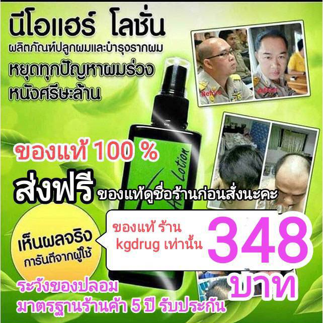 neo-hair-lotion-ของแท้-เซรั่มปลูกผม-นีโอแฮร์โลชั่น-neohair-นีโอแฮร์-ของแท้-ส่งด่วนทุกวัน-จากโรงงาน