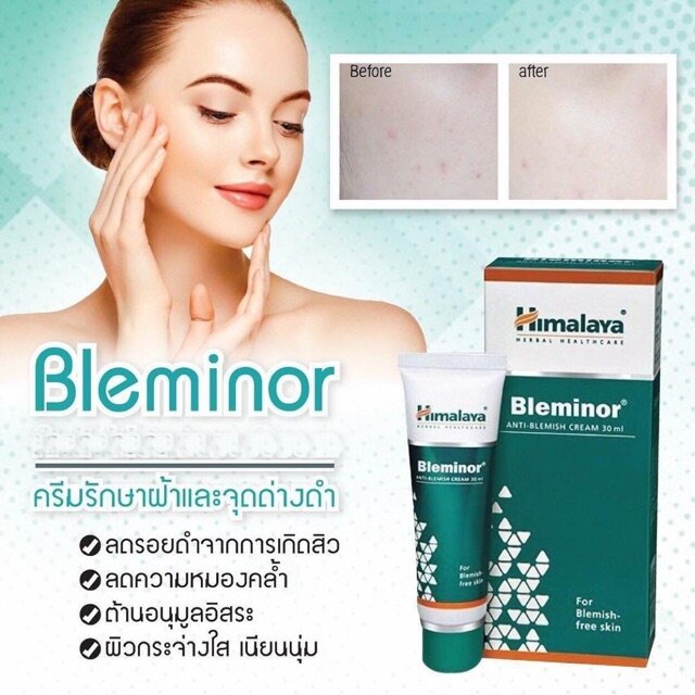 bleminor-anti-blemish-cream-30ml-ครีมลดฝ้า-กระ-ฝ้าจากสิว-ผลิตในอินเดีย