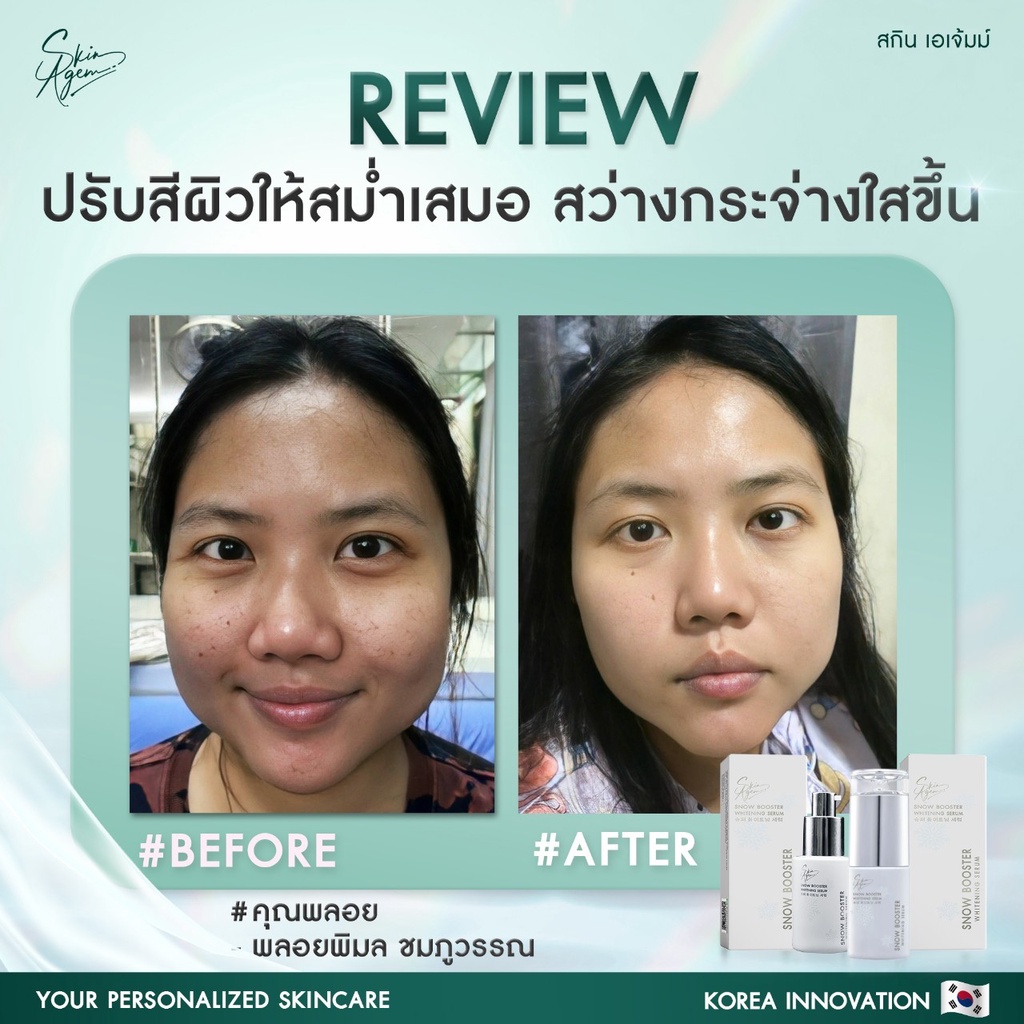 1แถม1-จัดส่งฟรี-skin-agem-snow-booster-whitening-serum-ปรับผิวขาวใส-ตั้งแต่ครั้งแรกที่ใช้-ลดรอยดำ-รอยแดง-จากสิว-ฝ้า