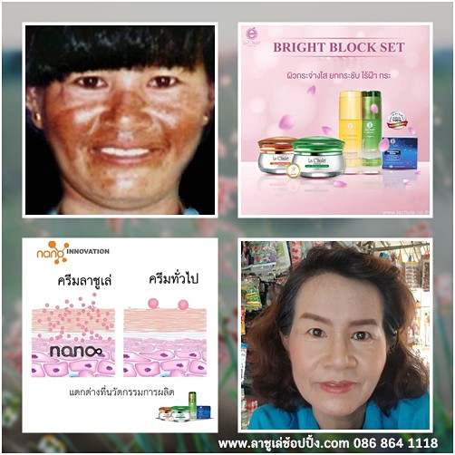 สมัครสมาชิกฟรี-พร้อมรับส่วนนลด20-ทันที-ลาชูเล่-lachule-ชุดไบร์ทบล็อคเซ็ท-ชุดรักษากระ-ฝ้า-หน้าขาวใส-ครบจบเรื่องฝ้า