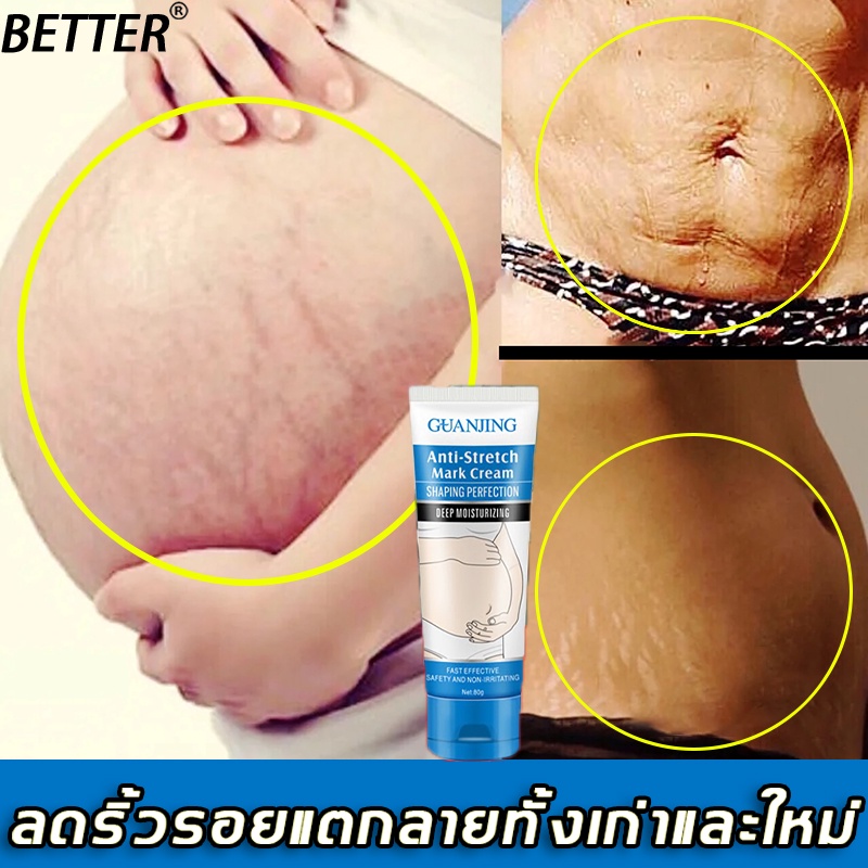 better-ครีมทาท้องลาย-80g-พัฒนาขึ้นเป็นพิเศษสำหรับหญิงตั้งครรภ์-ซ่อมแซมและลบเลือนรอยแตกลาย-ครีมท้องแตกลาย-ครีมกันแตกลาย