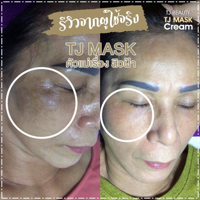 ครีมโสมลดฝ้า-สิว-ทาก่อนนอนไม่ต้องล้างออก-มีเลขจดแจ้ง-tj-mask