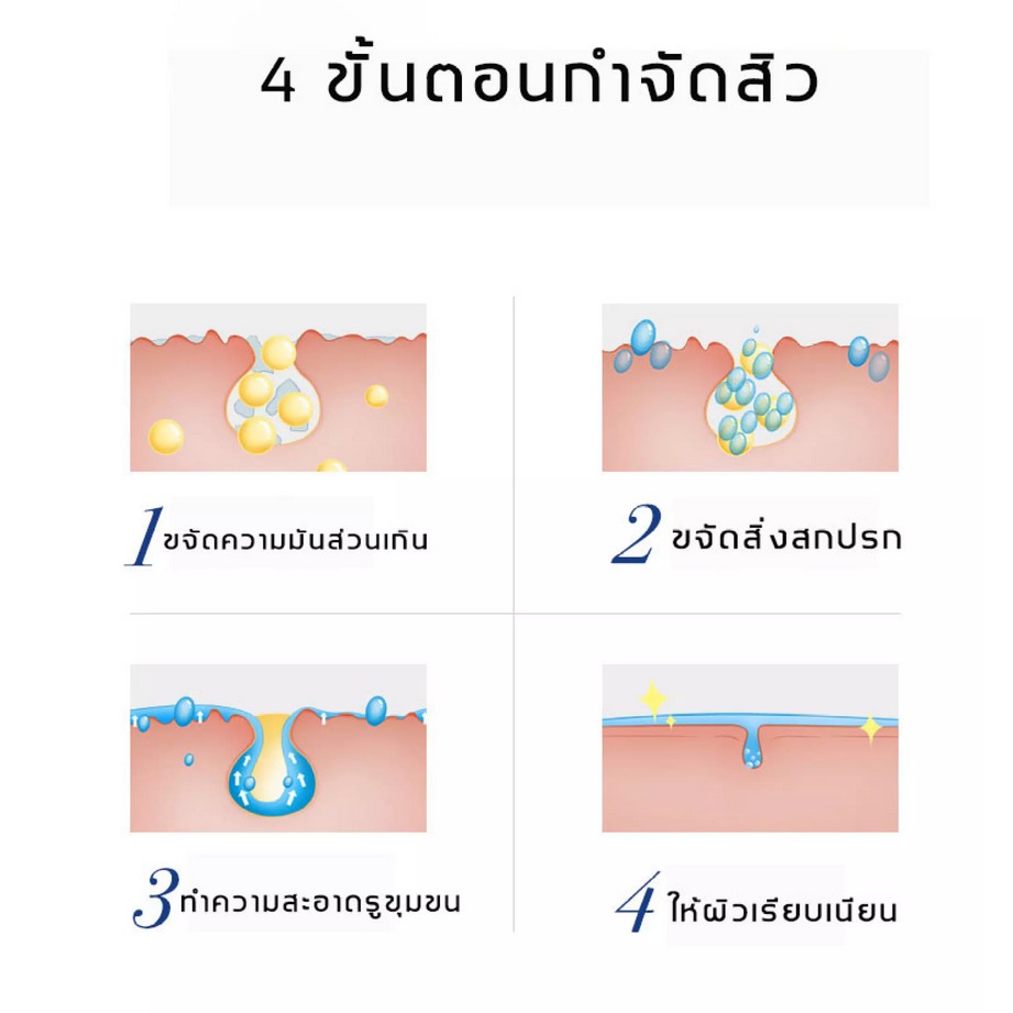 dr-ledun-ครีมลดสิว-20g-ครีมแก้ฝ้า-สิวหายถาวร-ครีมแต้มสิว-เจลรักษาสิว-เจลแต้มสิว-ครีมกำจัดสิว-ครีมบำรุงหน้า-ครีมหน้าขาวใส