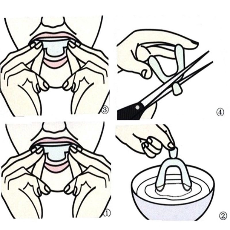 ส่งฟรี-ซิลิโคนสำหรับฟอกสีฟัน-diy-2-ชิ้น-แบบแยกขาย