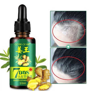 ♕ exo ღ Hair Loss Treatment Ginger Hair Growth Serum For Thicker Healthier Hair