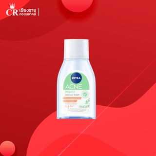 นีเวีย ไมเซล่า แอคเน่ รีแพร์ แอดวานซ์ 75 มล. ขนาดพกพา NIVEA Acne Repair Advance Micellar คลีนซิ่ง ลบเครื่องสำอาง