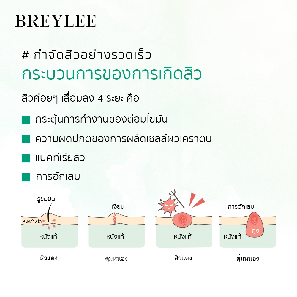 breylee-กรดซาลิไซลิก-40-ชิ้น-แผ่นทําความสะอาดผิวหน้า-กรดซาลิซิลิก-สำหรับ-ควบคุมความมัน-ลดสิว-กระชับรูขุมขน-ซ่อมแซมผิว-ลบสิวหัวดำ-ทำความสะอาดล้ำลึก-ต้านการอักเสบ-cleanser-salicylic-acid
