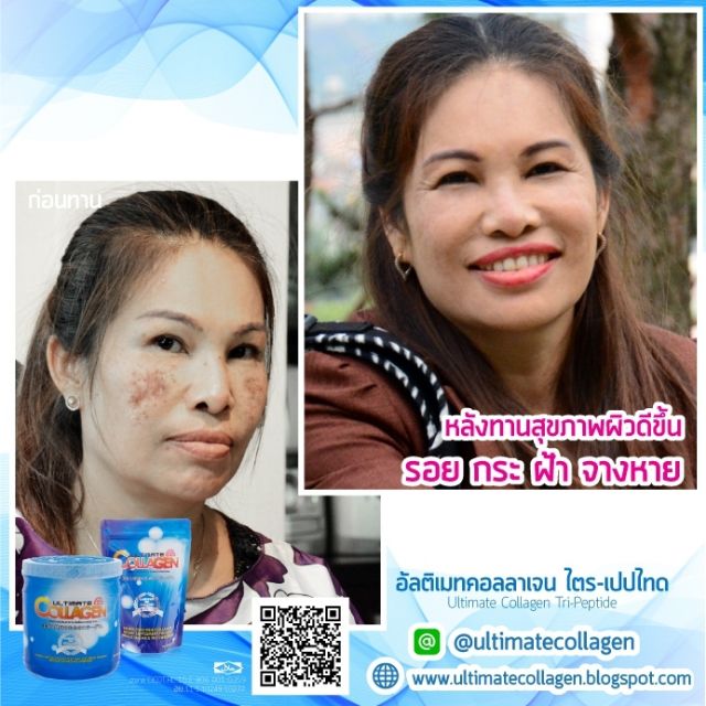 ภาพสินค้าUltimate Collagen (50 กรัม 9 ซอง) อัลติเมทคอลลาเจนไตรเปปไทด์ จากร้าน utimate บน Shopee ภาพที่ 7