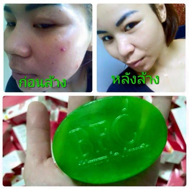 bfc-greentea-soap-สบู่ชาเขียว-หน้าใส-ลดสิว-สบู่bfc-ชาเขียว-ขนาด-50-g