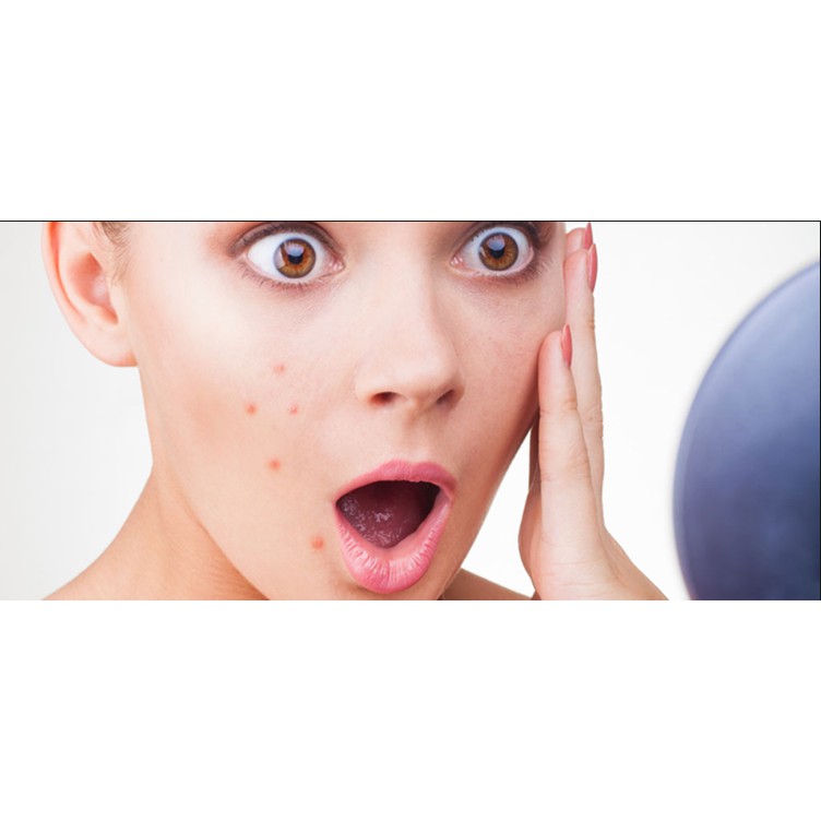 kiehls-breakout-control-targeted-acne-spot-treatment-20ml-ยาแต้มสิว-คีลส์