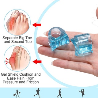 เครื่องมือซิลิโคนแยกนิ้วเท้า Hallux Valgus Hallux Bursitis ปะเก็นดูแลเท้า