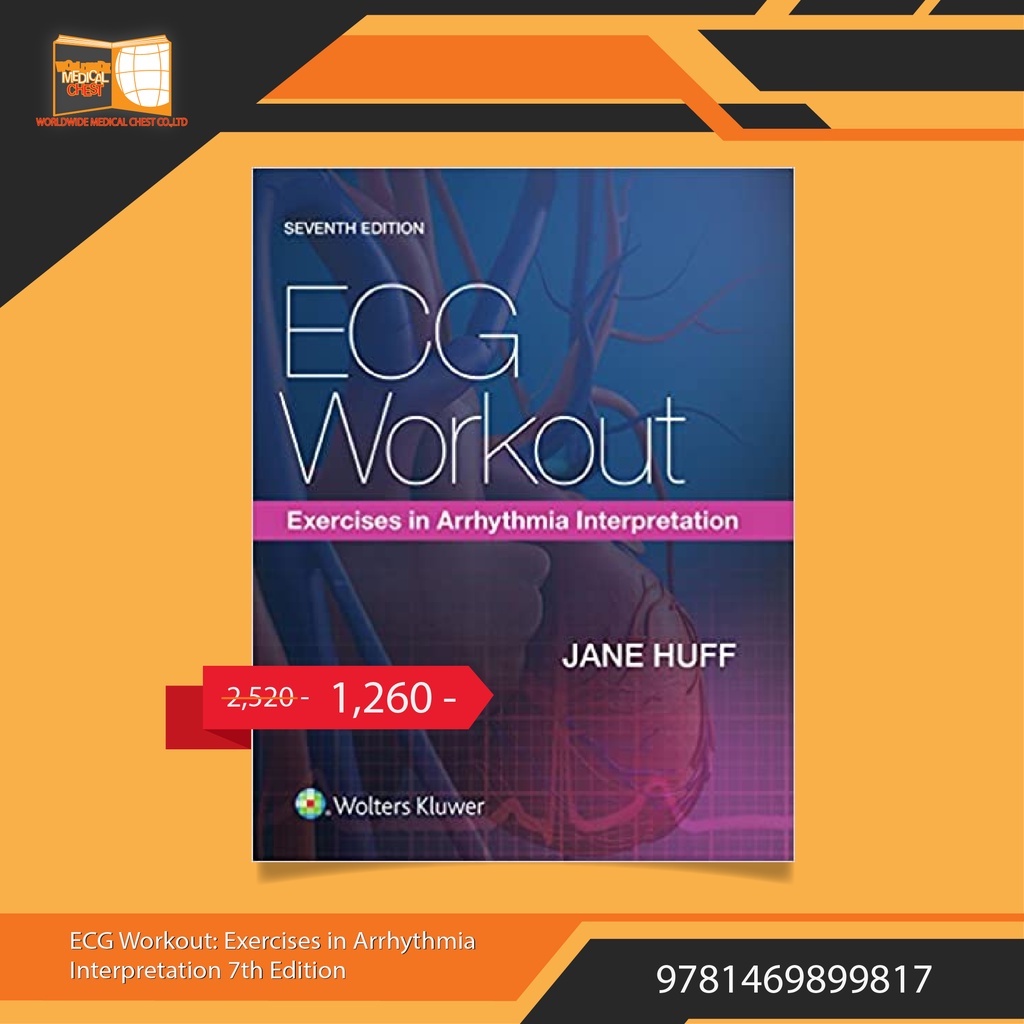 ECG Workout Exercises in Arrhythmia Interpretation 7th Edition