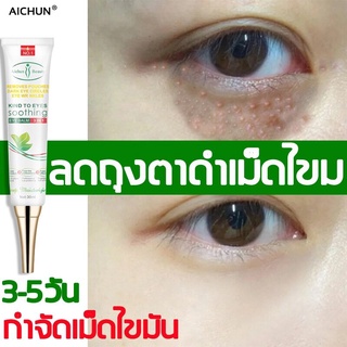 Aichun ครีมกำจัดถุงใต้ตา ครีมบำรุงใต้ตา เซรั่มทาถุงใต้ตา 30ml ลบคล้ำบวมใต้ตา กระชับรอยตีนกา บรรเทาปัญหาต่างๆรอบดวงต