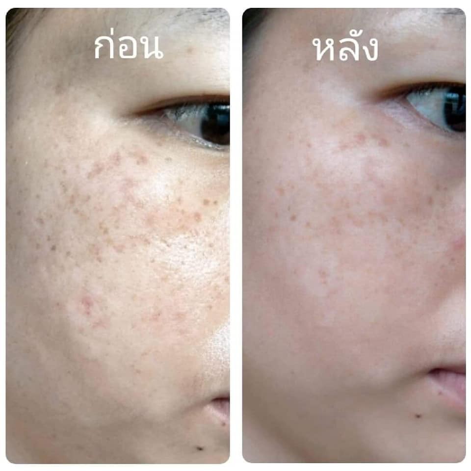 ครีมลบริ้วรอยย่น-คลีนิคคุณหมอสมศักดิ์