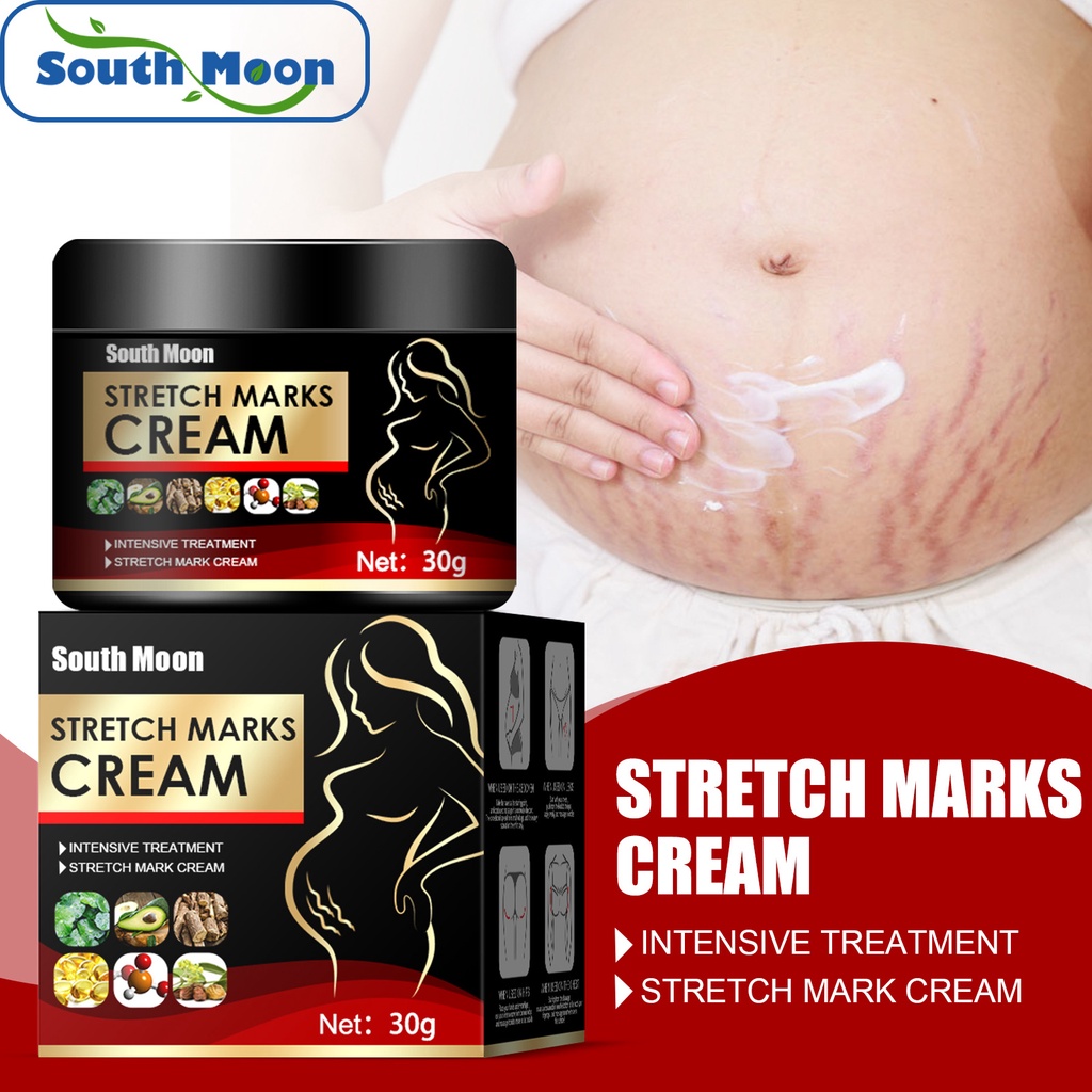 South Moon Stretch Mark Repair Cream Fade หลังคลอดไขมันยืด Mark Growth ...