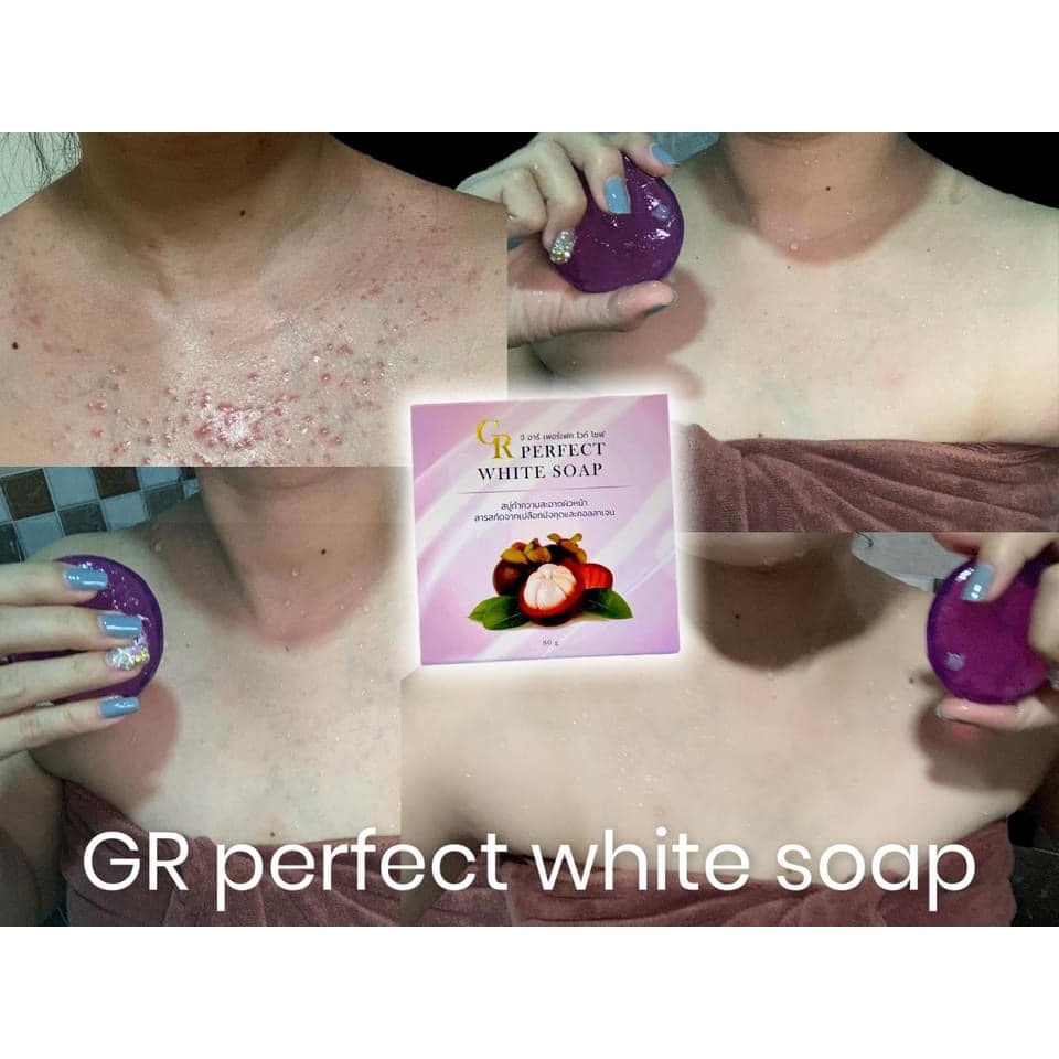 สบู่-gr-perfect-white-soap-ทำความสะอาดผิวหน้า-สบู่รักษาสิว-แพ็คเกจใหม่