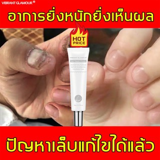 สินค้า VIBRANTGLAMOURซ่อมแซมเล็บกำจัดเชื้อราที่เล็บดูแลเล็บฉีกแตกเล็บหัก บำรุงรักษาเล็บซ่อมแซมเล็บที่เสียหายดูแลเล็บNailrepair