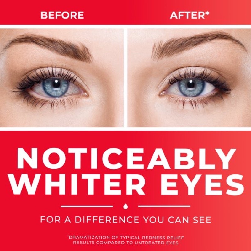 ของแท้-clear-eyes-ลดอาการตาแห้ง-ลดตาแดง-เพิ่มความชุ่มชื่นให้กับดวงตา-ขนาด-6-ml