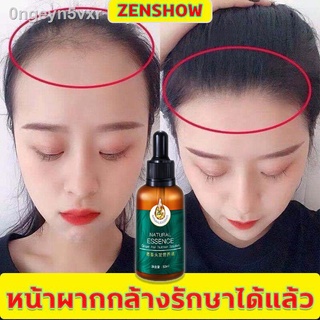 ZENSHOW น้ำยาปลูกผม เซรั่มปลูกผม เซรั่มบำรุงผม บำรุงผม เซรั่มบำรุง ยาปลูกผมของแท้ น้ำยาเร่งผมยาว ป้องกันผมร่วงก่อน ค่อยป