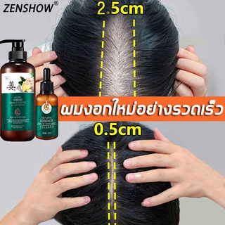 ของแท้100%ZENSHOW แชมพูขิง แชมพูแก้ผมร่วง (แชมพูขิงเพียว แชมพูขิง บำรุงหนังศรีษะ แชมพูปลูกผม สระผมแก้ร่วง)