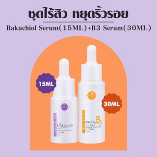 VIKKASKINCARE V-active A Bakuchiol 15 ml + V-active B3 Zinc PCA 30 ml คู่เซรั่มผิวใสไร้สิวและริ้วรอย กระชับผิว