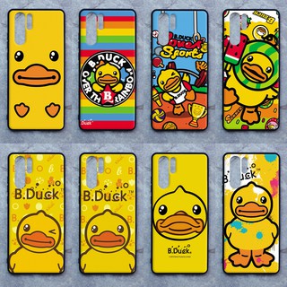 เคส Huawei P30 pro ลายเป็ดน้อยน่ารัก ขอบนิ่มหลังแข็ง เคส ถือ เคส Caseเคส TPU ขอบนิ่มหลังแข็ง ไม่ขูดตัวเครื่อง ไม่กัดขอบช