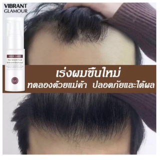 ปลูกผม เซรั่มปลูกผม ป้องกันผมร่วง เพื่อผมหนา ผมเงา ผมดกกำ บำรุงรากผม Hair Growth ยาปลูกผม น้ำยาปลูกผม บำรุงผม