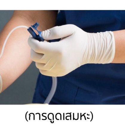 สายดูดเสมหะ-suction-catheter-แบบมี-fingertip-control-1-แพ็ค-จำนวน-50-เส้น