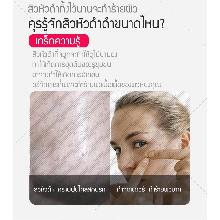 ที่ดูดสิว-สิวเสี้ยน-สิวข้างจมูก-ดูดสิวอุดตัน-ลดจุดด่างดำบนใบหน้า-เครื่องดูดสิว