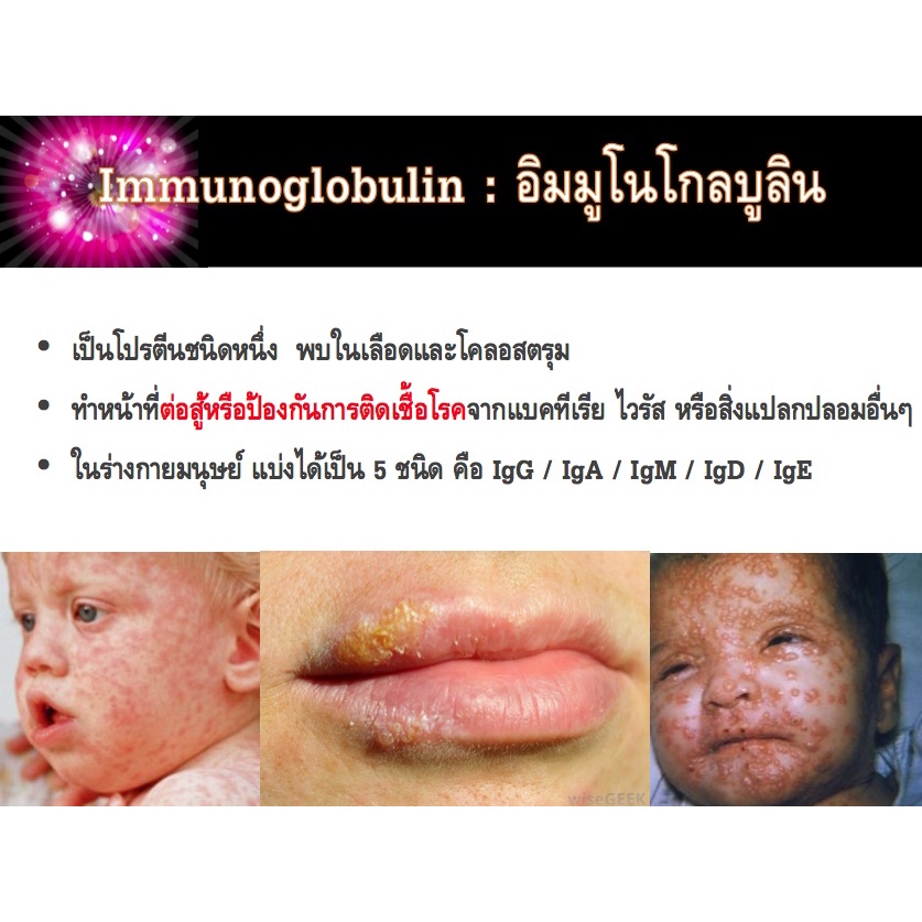 ซื้อ-1-แถม-1-the-warrior-สร้างเสริมภูมิคุ้มกันอย่างมีประสิทธิภาพ