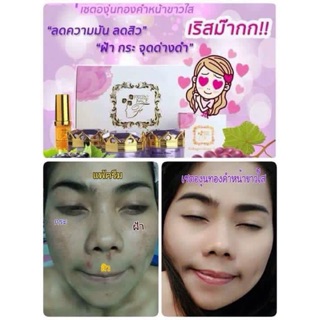 เซตองุ่นทองคำ หน้าขาวใส