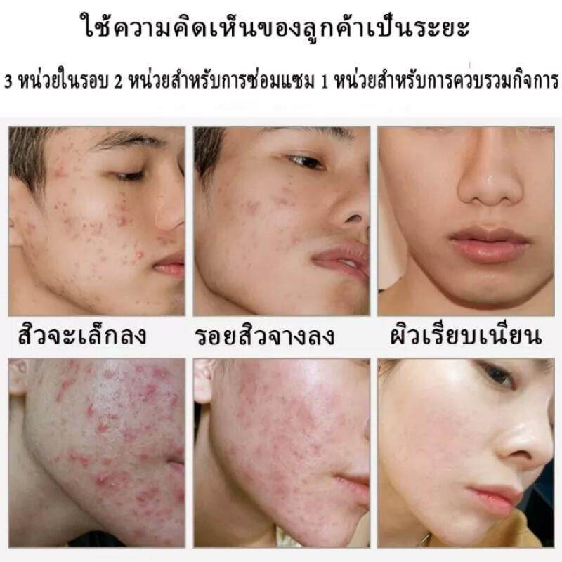 ครีมแต้มสิว-elaimei-ครีมลดสิว-ครีมรักษาสิว-ทำความสะอาดองล้ำลึก-สิวหายถาวร-เจลแต้มสิว-50g-เจลแต้มสิว-ครีมรักษาสิว-เซรั่มแต้มสิว-เจลรักษาสิว-ครีมกำจัดสิว