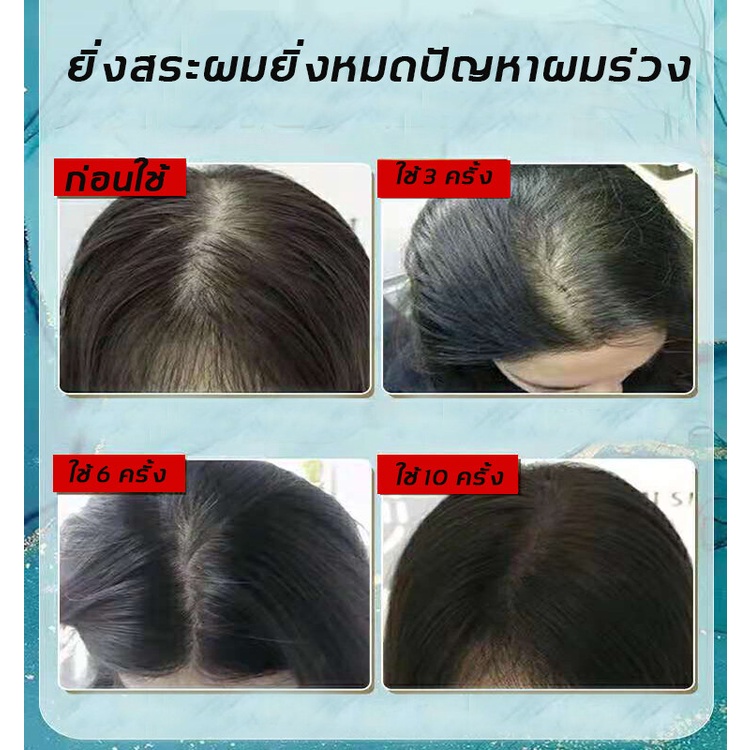 peimei-แชมพูสมุนไพรขิงบำรุงผม-250ml-แชมพูปลูกผม-แชมพูปลูกผมดก-ยาสระผมเร่งผมยาว-แชมพูขิง-แชมพูสมุนไพร-แชมพูบำรุงผม