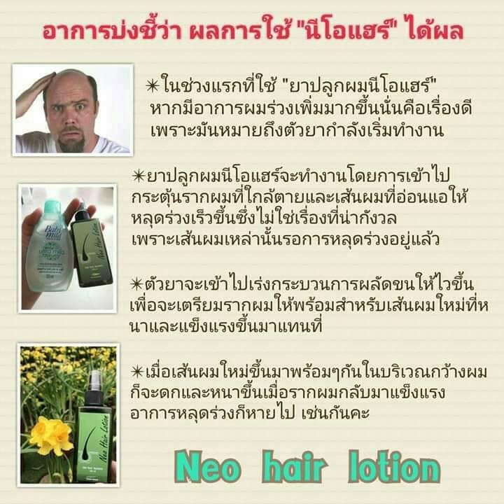 ระวังปลอม-ของแท้จากบริษัท-นีโอแฮร์โลชั่น-หนึ่งขวด-ผลิตภัณฑ์บำรุงรากผม-และ-หนังศีรษะ-neo-hair-lotion