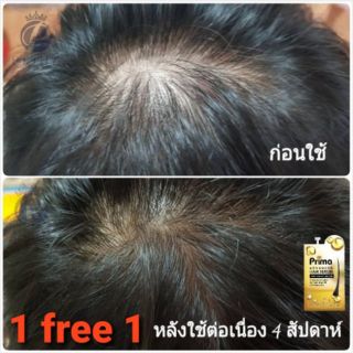 ภาพหน้าปกสินค้า(1ฟรี1)เซรั่มปลูกผม และบำรุงเส้นผม (แบบซอง) ที่เกี่ยวข้อง