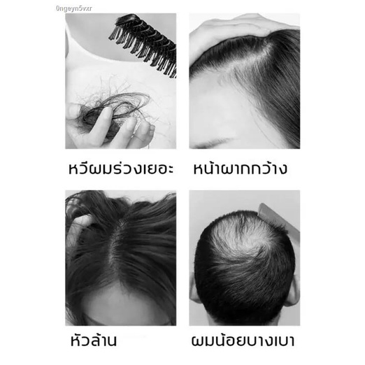 จัดส่งทันที-บอกลาปัญหาผมร่วง-aopy-30g-เซรั่มบำรุงผม-บำรุงผม-ลดผมร่วง-หยุดผมร่วง-เร่งผมยาว-ให้คุณบอกลาปัญหาผมร่วง-ฟื้