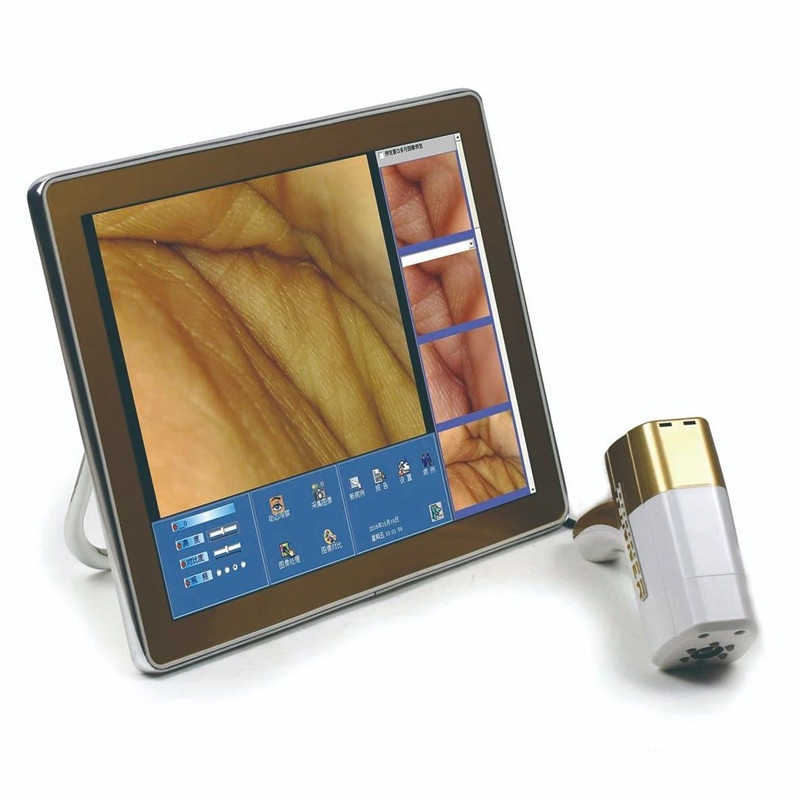 portable-colposcope-cervical-detection-instrument-female-private-inspection-mirror-hd-gynecological-endoscope-speculum-y