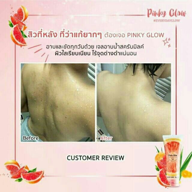 ราคาพิเศษเดือนพฤศจิกายน-และแถมฟรี-ใยขัดตัวเมื่อซื้อเจลอาบน้ำpinky-glow-ด่วนของแถมมีจำนวนจำกัด