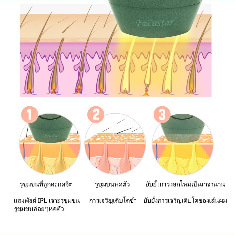 จุดในไม่กี่วินาที-เครื่องกำจัดขนด้วยเลเซอร์-focustar-รุ่นอัพเกรด-600000-ครั้ง-flash-ipl-laser-hair-removal