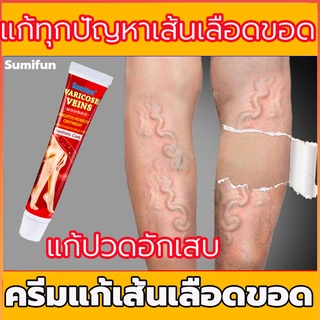 สินค้า Sumifun ครีมทาเส้นเลือดขอด 20g แก้ปัญหาหลอดเลือดขอดได้ง่ายงาย(ยาทาเส้นเลือดขอด ครีมเสเนเลือดขอด