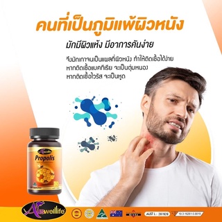 ภาพขนาดย่อของภาพหน้าปกสินค้าPropolis พรอพอลิส 1000มก. ลดการเกิดสิว สิวหายเร็วขึ้น ลดการอักเสบของสิว(ส่งฟรี) จากร้าน ninenustore บน Shopee ภาพที่ 7