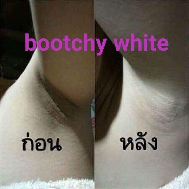 ครีมก้นขาว-แก้คอดำ-แก้ขาหนีบดำ-bootchy-white