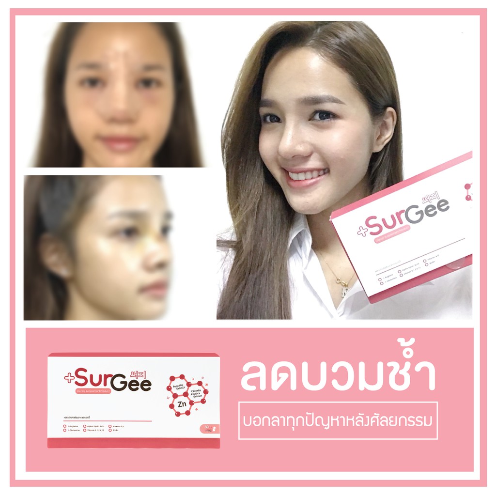 Surgee เซอร์จี้ ยาลดบวม ลดรอยช้ำเร่งสมานแผลหลังศัลยกรรม | Shopee Thailand